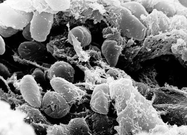 Een zwart-wit microscoopbeeld van ovale pestbacteriën tussen kleverige draadjes.
